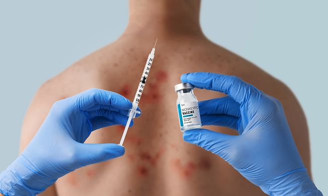 Luxembourg residents will be able to be vaccinated against monkeypox from next week