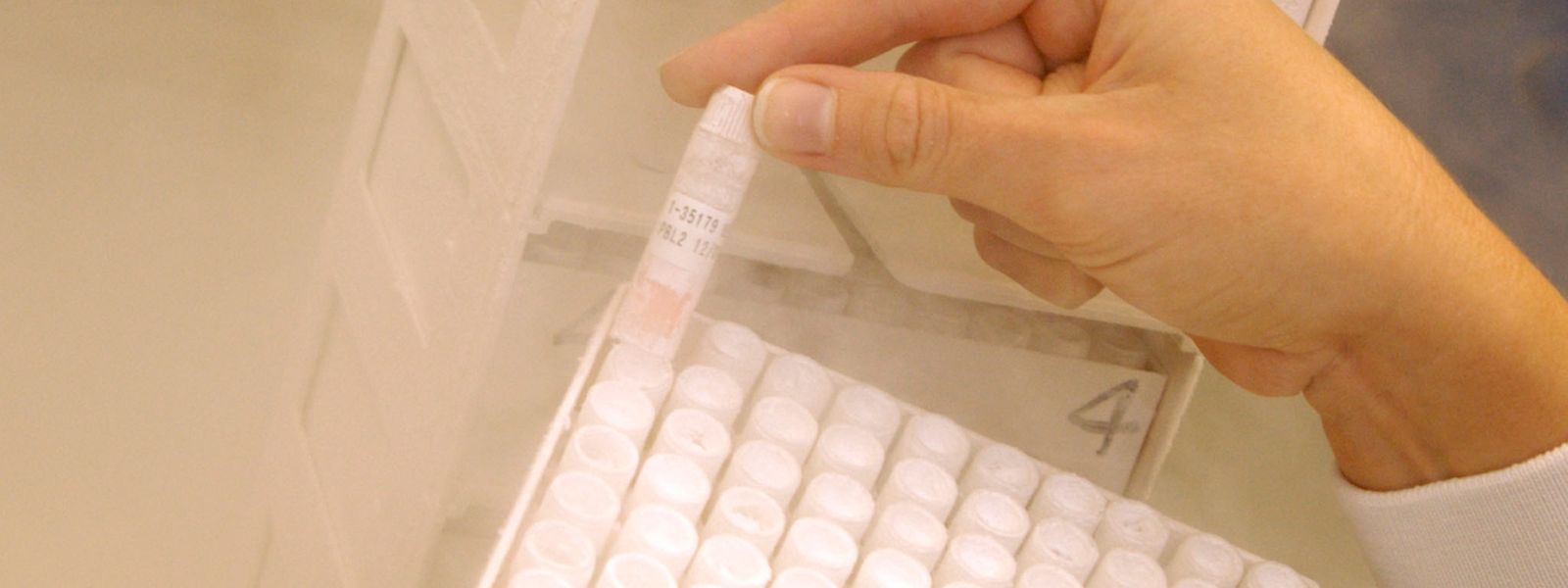 87.000 échantillons d'ADN sont stockés dans de l'azote à -176°C.