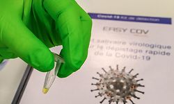 (FILES) In this file photo taken on October 13, 2020 a researcher from the Sys2Diag laboratory, of the biotechnology company SkillCell, shows a rapid-acting saliva-based test EasyCov, with a yellow reagent positive for the disease Covid-19, in Montpellier, southern France. - The EasyCOV Fast Acting Saliva Test is used by healthcare professionals and works with the reagents at a temperature of 65 celsius degrees for 30 minutes after collecting the saliva sample. The test results are read by colorimetric analysis. (Photo by Pascal GUYOT / AFP)